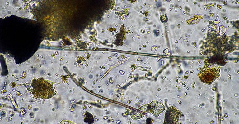Economic Mycology MCQs